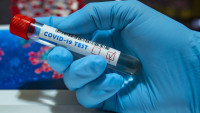 covid test-19-5070657 1280